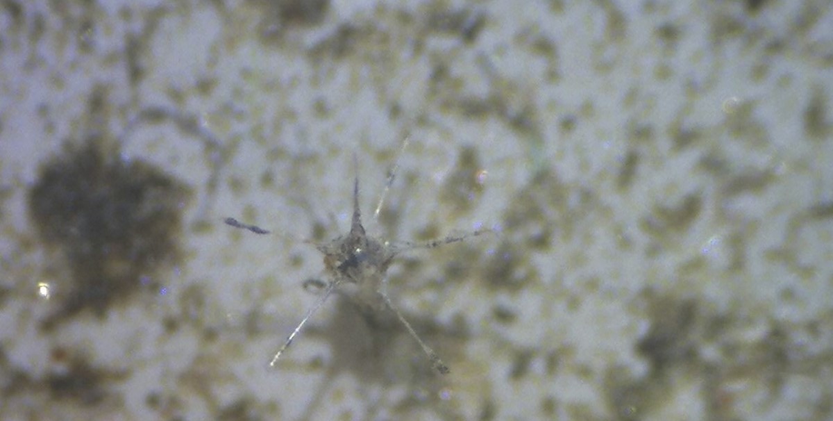  Little critters on the filter: a radiolarian (?)